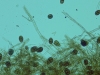 Alternaria alternata